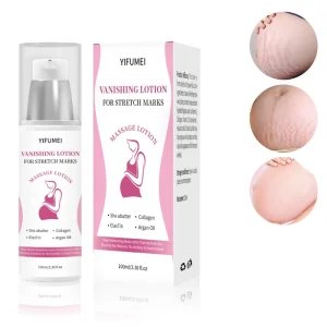 Private Label Organic Non-Irritating Fast Acting Smooth Skin Nourishing Moisturize Stretch Mark Stretch Repair Removal Cream