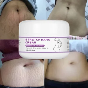 Private Label Pregnancy Scar Anti Stretch Mark Removal Cream