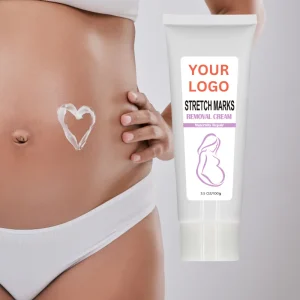 Private Label Repairing Mango Anti Stretch Mark Removal Cream