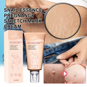 Private Label Snail Extract Natural Stretch Mark Repair Cream for Home Postpartum Mommy Pregnancy Stretch Mark Removal Cream OEM