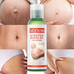 Private Label Stretch Marks Removal Essential Oil Effective Removal Scar Stretch Mark 100% Natural Stretch Mark Cream