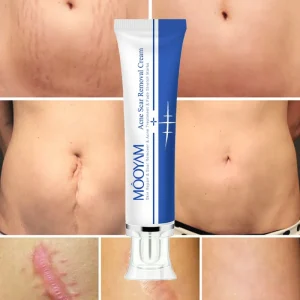 Private Label Strong Effective Acne Scar Pimples Custom logo Remove Face Gel Tummy Tuck Tightening Stretch Mark Removal Cream