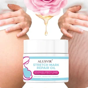 Private Label Vegan Maternity Skin Care Body Repair Anti Postpartum Deep Acne Scar Removal Strech Stretch Marks Removal Cream