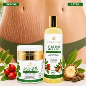 Private Label Vitamin C Snail Extract Postpartum Skin Care Cream Natural Organic Anti Pigmentation Firming Stretch Mark Women