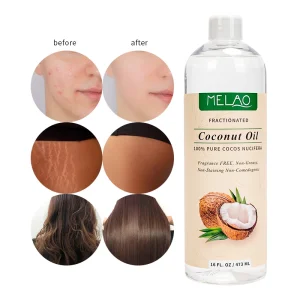Pure Private Label Coconut Oil Relaxing Massage Carrier Oil Diluting Essential Oils for Skin or Hair 16oz
