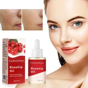 Rosehip Oil Essential Oil 100% Pure Cold Pressed Organic 30ml Rich in Vitamin a & C Brightening Moisturizing Bulk Price Low MOQ