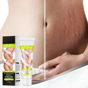 Scar Removal Face Cream Acne Pimples Stretch Marks Repair Cream