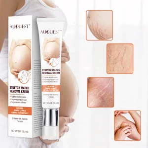 Skin Care After Pregnancy Repairing Stretch Marks Cream Private Label Acne Scar Removal Cream