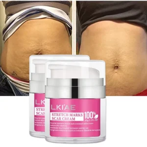Skin Repair Stretch Mark Cream Lightening Scar Stretch Mark Removal Cream