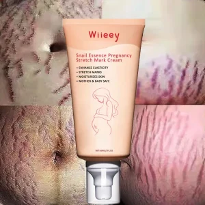 Snail Cream for Body Anti Stretch Mark Fade Fine Lines and Scars Gentle Care with Smooth Skin