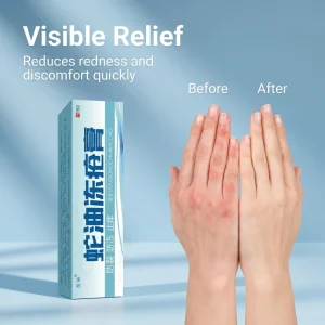 Snake Oil Winter Hand Care Cream Soothing Moisturizer for Dry Chapped Skin Anti Chapping Hand Body Skin Care Lotion