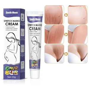 South Moon 100% Natural Postpartum Anti Vergetures for Pregnant Women Anti Stretch Mark Removal Cream