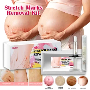 Stretch Mark Care Body Cream Black Skin Vegan Natural Collagen Strong Tummy Inner Thighs Arms Stretch Marks Scar Reduction Kit