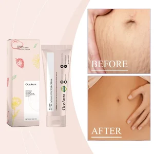 Stretch Mark Cream Cruelty free Lightens Fine Lines and Scars Smooths the Skin and Provides Gentle Care