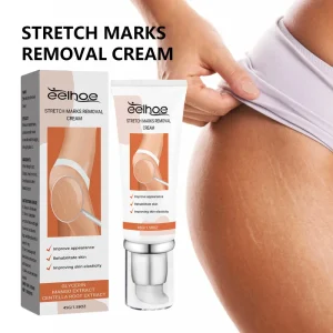 Stretch Mark Cream for Pregnancy Legs Thighs and Hips Prevention and Reduction Cream for Expecting Mothers