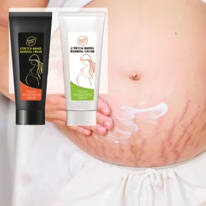 Stretch Mark Remover Cream 100g Body Butter Improve Skin Elasticity