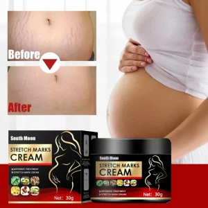 Stretch Mark Repair Cream Maternity Fades Postpartum Fat Growth Orange Peel Improve Scar Remover Skin Care Body