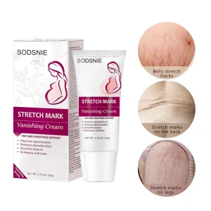 Stretch Mark Vanishing Cream Fragrance Free Available During Lactation Abdominal Stretch Mark Removal Cream Stretch Marks