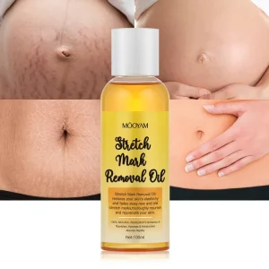 Stretch Marks Cream Essential Oil Private Label 100% Natural Pure Plant Extract 7 Days Scar Oil Stretch Mark Removal Oil