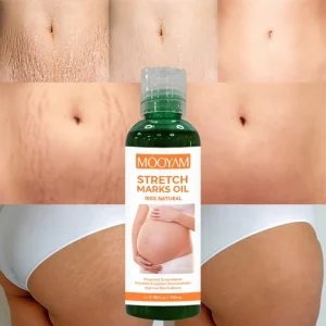 Stretch Marks Remover Oil with Vitamin E Natural Organic Body Coconut Scar Massage Oil Stretch Mark Cream