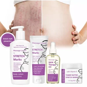 Strong Effective Natural Body Care Strech Marks Removal Cream Skin Care Products for Stretch Marks