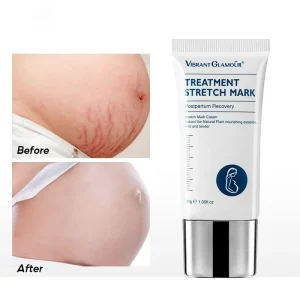 Strong Repair Stretch Marks Cream Deep Nourishing and Prevention with Natural Extraction Creamy Texture Not Greasy