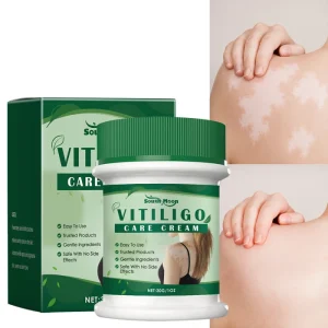 Vitiligo Piebald Treating Soft Ointment for External Use on the Skin Vitiliosis Sweat Spots Clearing Cream