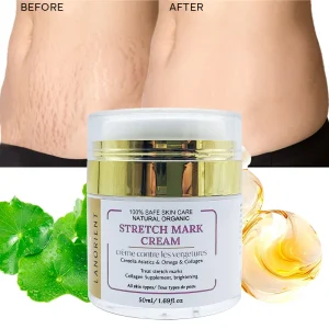Women’s Private Label Natural Organic Vitamin C Body Oil Skin Revitalizing Stretch Mark Removal and Moisturizing Cream