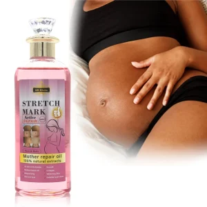 essential distiller Natural Extracts Removal Cream Products Treatment Scar Postpartum Repair Firming Body Stretch Marks Oil